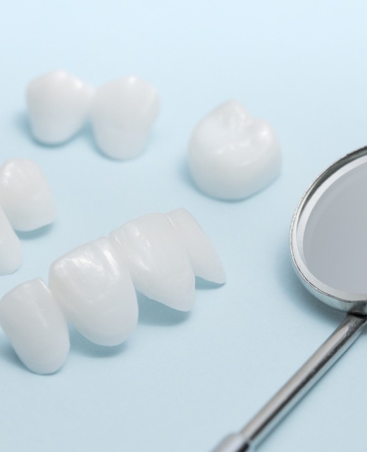 Samples of metal free dental crowns