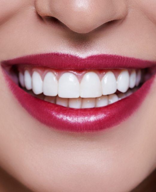 Closeup of smile after gum recontouring treatment