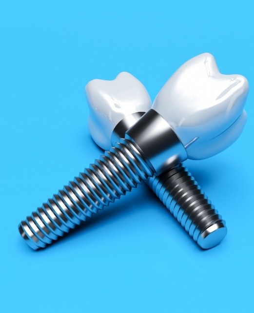 Two animated dental implant supported dental crowns