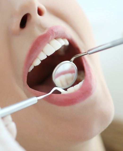 Dentist performing scaling and root planing treatment