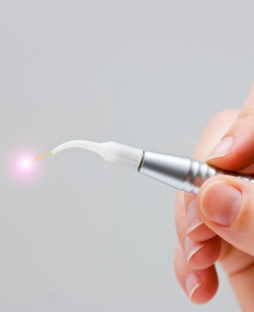Hand holding a laser dentistry device