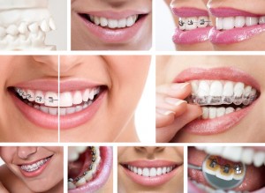 Wanting a straight smile? Dr. Edward Dooley offers options for braces in his Wall Township office. Learn what qualifies you for today’s orthodontics.