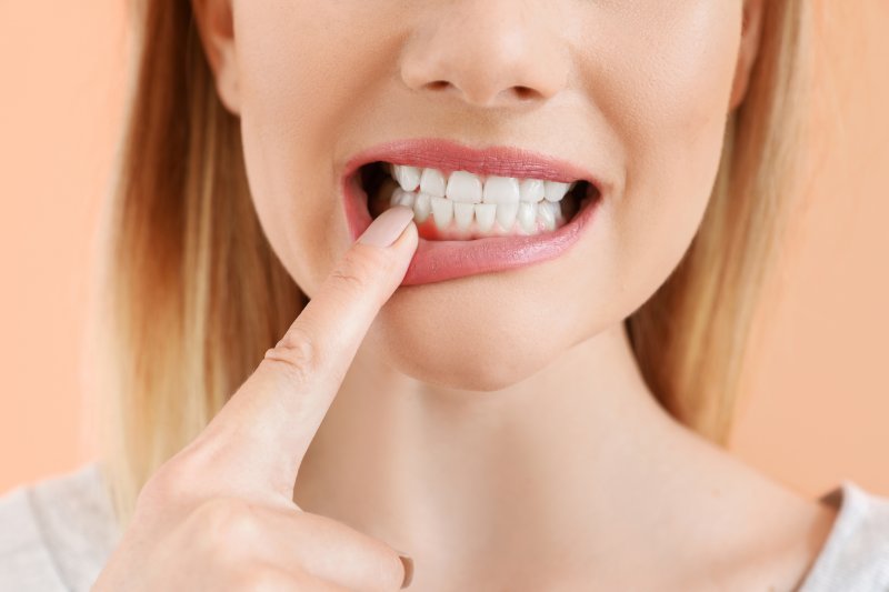 Woman pointing to her gums